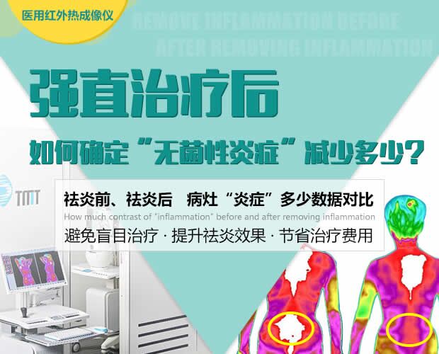 红外线热议.jpg