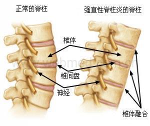 南京强脊诊疗中心