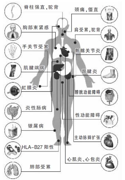 南京强脊诊疗中心