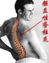 南京强脊诊疗中心