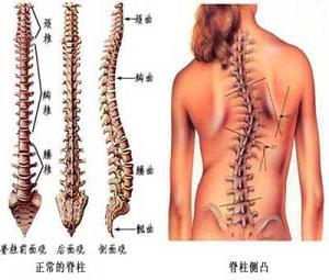 南京强脊诊疗中心