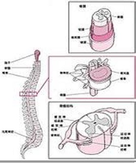 南京强脊诊疗中心强直性脊柱炎医院