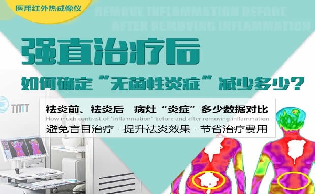 医用红外热成像仪.jpg