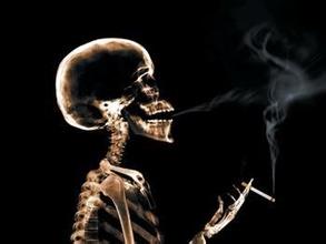 南京强脊诊疗中心强直性脊柱炎医院